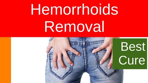 straining during bowel movements. . Are hemorrhoids a turn off